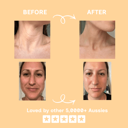 Radianceur™ EMS Red Light Therapy Tool