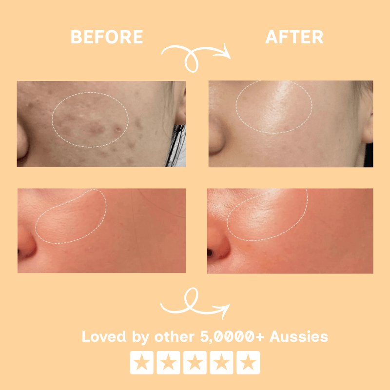 Radianceur™ Collagen Jelly Cream